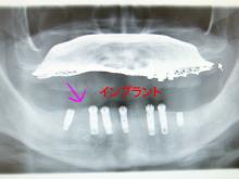 安部歯科医院のブログ