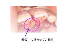 安部歯科医院のブログ