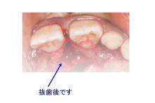 安部歯科医院のブログ
