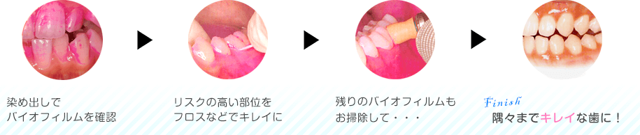 どんなことをするの?
